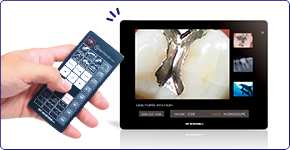 Features -Remote Control-