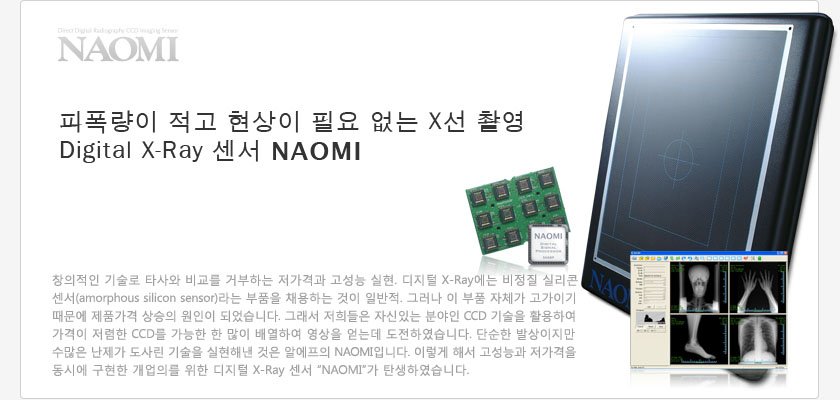 피폭량이 적고 현상이 필요 없는 X선 촬영 디지털 X선 센서 디지트겐 NAOMI.
